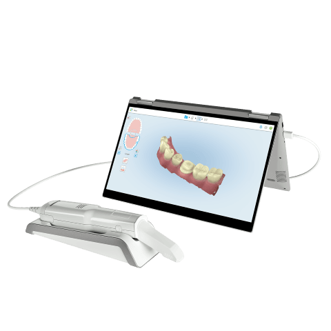iTero Digital Dental Impressions make it easier for dental implants