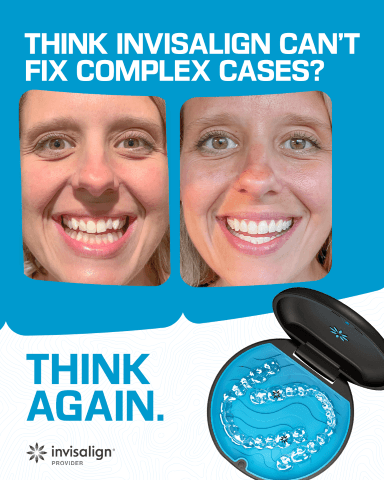 Am I Too Old for Invisalign®? What Adults Should Know Before Starting Treatment