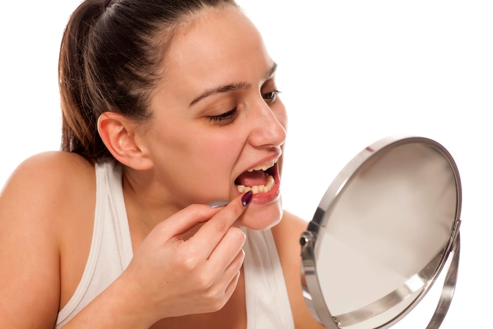 Food in Teeth